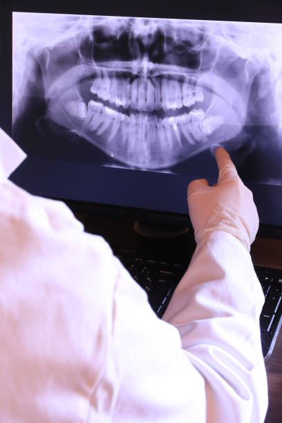Best Dentist for Tooth Abscess  in Roberta, GA